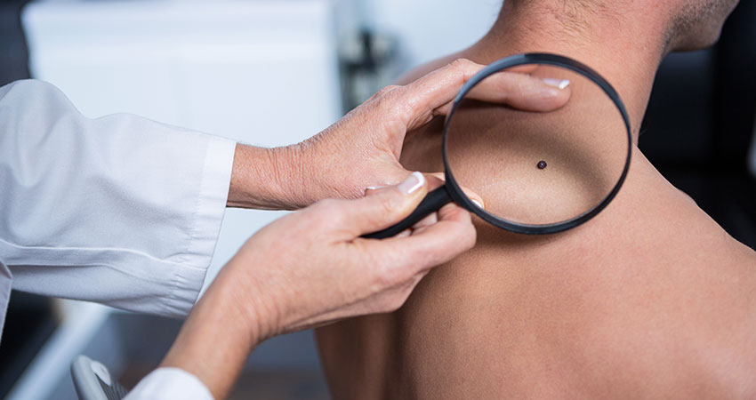 Skin Cancer
